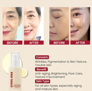 Korean serum SEOUL 1988